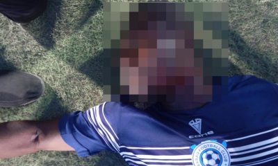 Barau FC Player Stabbed in the Neck During NPFL Match in Katsina
